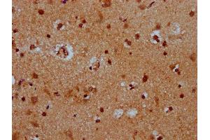 IHC image of ABIN7172561 diluted at 1:400 and staining in paraffin-embedded human brain tissue performed on a Leica BondTM system. (HES5 antibody  (AA 1-166))