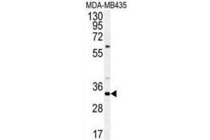 Western Blotting (WB) image for anti-Coiled-Coil Domain Containing 101 (CCDC101) antibody (ABIN3002249) (SGF29 antibody)