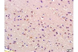 Formalin-fixed and paraffin embedded rat brain labeled with Anti-P105 RB Polyclonal Antibody, Unconjugated (ABIN680548) at 1:200 followed by conjugation to the secondary antibody and DAB staining (Retinoblastoma 1 antibody  (AA 51-150))