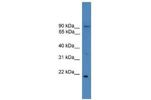 Western Blot showing FOXM1 antibody used at a concentration of 1. (FOXM1 antibody  (N-Term))