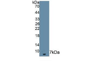 Detection of Recombinant IL18R1, Human using Monoclonal Antibody to Interleukin 18 Receptor 1 (IL18R1) (IL18R1 antibody  (AA 375-428))