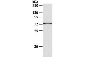 Western Blot analysis of PC3 cell using CD156c Polyclonal Antibody at dilution of 1:300 (ADAM10 antibody)