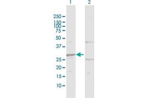 Western Blot analysis of HIBADH expression in transfected 293T cell line by HIBADH MaxPab polyclonal antibody. (HIBADH antibody  (AA 1-336))