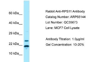 Western Blotting (WB) image for anti-Ribosomal Protein S11 (RPS11) (N-Term) antibody (ABIN971622) (RPS11 antibody  (N-Term))