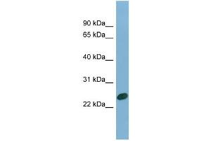 WB Suggested Anti-CHMP1B Antibody Titration: 0. (CHMP1B antibody  (N-Term))