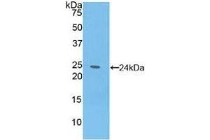Detection of Recombinant IL6, Ovine using Polyclonal Antibody to Interleukin 6 (IL6) (IL-6 antibody  (AA 30-208))