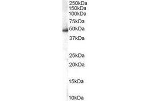 Western Blotting (WB) image for anti-Sorting Nexin 5 (SNX5) (C-Term) antibody (ABIN2466297) (SNX5 antibody  (C-Term))