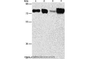 Western blot analysis of Hepg2 and hela cell, human fetal kidney and liver tissue, using ACSL4 Polyclonal Antibody at dilution of 1:650 (ACSL4 antibody)