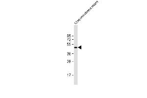 Anti-HIS Tag Antibody at 1:2000 dilution + 12tag recombinant protein lysate Lysates/proteins at 20 μg per lane. (His Tag antibody)