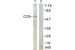 Western blot analysis of extracts from 293 cells, treated with PMA (125ng/ml, 30mins), using CD5 (Ab-453) antibody. (CD5 antibody  (Tyr453))