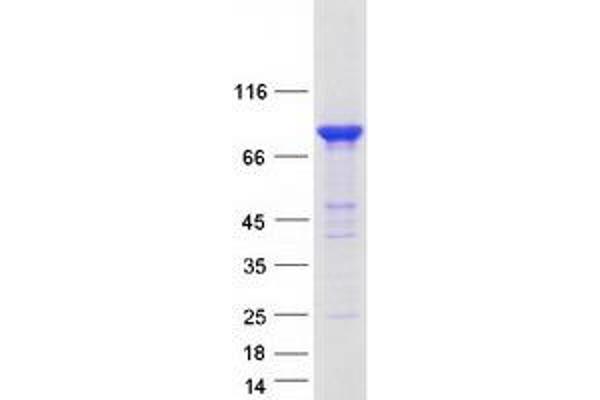 MALT1 Protein (Transcript Variant 2) (Myc-DYKDDDDK Tag)