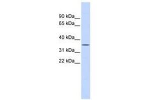 Image no. 1 for anti-Ficolin (Collagen/fibrinogen Domain Containing) 1 (FCN1) (AA 180-229) antibody (ABIN6743782) (FCN1 antibody  (AA 180-229))