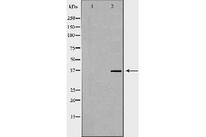 Western blot analysis of Jurkat whole cell lysates, using ACP5 Antibody. (ACP5 antibody  (N-Term))