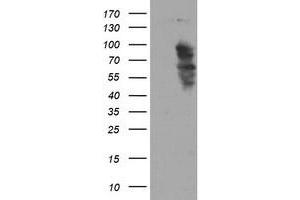 HEK293T cells were transfected with the pCMV6-ENTRY control (Left lane) or pCMV6-ENTRY SOX5 (Right lane) cDNA for 48 hrs and lysed. (SOX5 antibody)