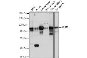Western blot analysis of extracts of various cell lines, using  antibody (ABIN7265426) at 1:1000 dilution. (ACSS1 antibody  (AA 340-689))