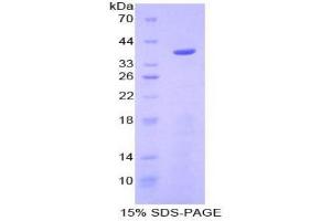 SDS-PAGE analysis of Mouse Apolipoprotein C1 Protein. (APOC1 Protein)