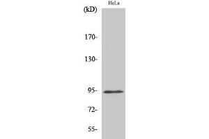Western Blot analysis of Hela cells with Phospho-Stat6 (Tyr641) Polyclonal Antibody (STAT6 antibody  (pTyr641))