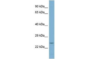 Host:  Rabbit  Target Name:  KDSR  Sample Type:  PANC1 Whole cell lysates  Antibody Dilution:  1. (FVT1 antibody  (N-Term))