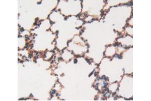 Figure. (MMP12 antibody  (AA 20-99))