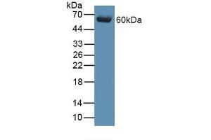 Detection of ARRb1 in Porcine Brain Tissue using Polyclonal Antibody to Arrestin Beta 1 (ARRb1) (beta Arrestin 1 antibody  (AA 3-246))