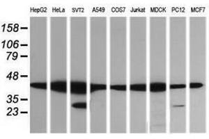 Image no. 1 for anti-Mitogen-Activated Protein Kinase Kinase 1 (MAP2K1) antibody (ABIN1499387) (MEK1 antibody)