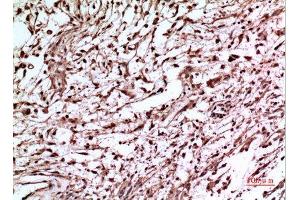 Immunohistochemistry (IHC) analysis of paraffin-embedded Human Brain, antibody was diluted at 1:100. (p53 antibody  (Tyr216))