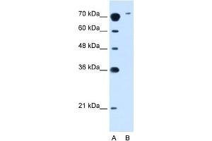 WB Suggested Anti-SLC7A14 Antibody Titration:  2. (SLC7A14 antibody  (N-Term))