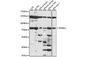 Western blot analysis of extracts of various cell lines, using THNSL1 antibody (ABIN6293622) at 1:1000 dilution. (THNSL1 antibody)