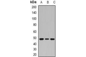 Western blot analysis of PHF6 expression in HEK293T (A), Jurkat (B), HepG2 (C) whole cell lysates. (PHF6 antibody)
