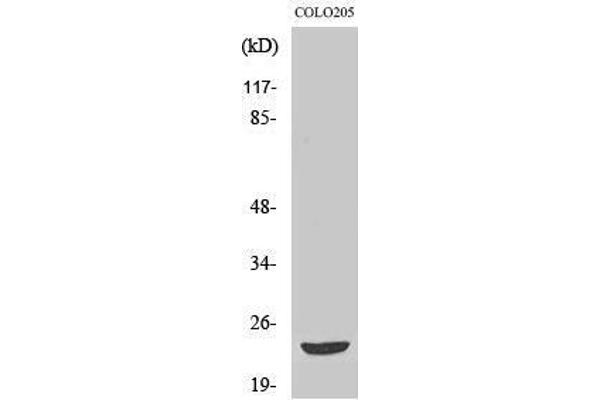 MOBKL2B antibody  (Internal Region)