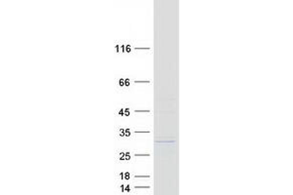 METTL20 Protein (Transcript Variant 1) (Myc-DYKDDDDK Tag)