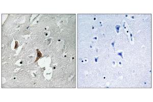 Immunohistochemistry analysis of paraffin-embedded human brain tissue using NMDAR2B (Phospho-Tyr1336) antibody. (GRIN2B antibody  (pTyr1336))