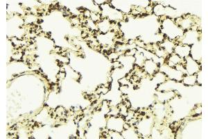 ABIN6268908 at 1/100 staining Mouse lung tissue by IHC-P. (Aurora Kinase B antibody)