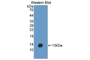 Western blot analysis of the recombinant protein. (Anoctamin 6 antibody  (AA 744-824))