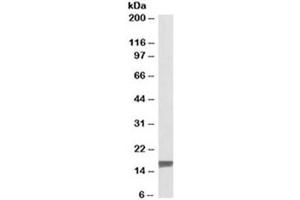 Western blot testing of human breast cancer lysate with TSPO antibody at 0. (TSPO antibody  (Isoform 1))