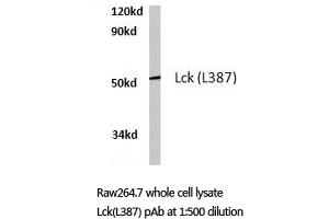 Western blot (WB) analyzes of Lck antibody in extracts from RAW264. (LCK antibody)
