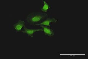 Immunofluorescence of purified MaxPab antibody to FOXJ2 on HeLa cell. (Forkhead Box J2 antibody  (AA 1-574))
