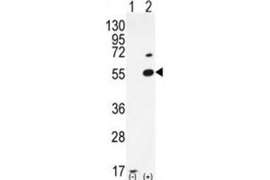 Western Blotting (WB) image for anti-Protein Arginine Methyltransferase 2 (PRMT2) antibody (ABIN2995499) (PRMT2 antibody)