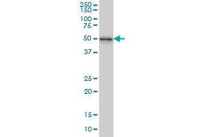 NEK2 monoclonal antibody (M11), clone 3B7 Western Blot analysis of NEK2 expression in MCF-7 . (NEK2 antibody  (AA 331-445))