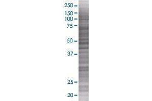 ENPP4 transfected lysate. (ENPP4 293T Cell Transient Overexpression Lysate(Denatured))