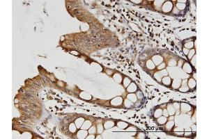 Immunoperoxidase of monoclonal antibody to TUBB2A on formalin-fixed paraffin-embedded human colon. (TUBB2A antibody  (AA 1-445))