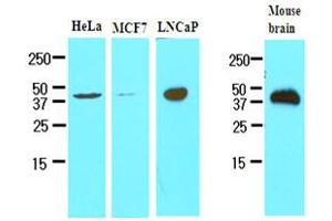 Western Blotting (WB) image for anti-Triggering Receptor Expressed On Myeloid Cells 2 (TREM2) (AA 19-161) antibody (ABIN2565046) (TREM2 antibody  (AA 19-161))