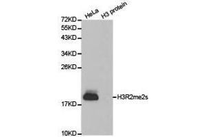 Western Blotting (WB) image for anti-Histone 3 (H3) (H3R2me2s) antibody (ABIN1873009) (Histone 3 antibody  (H3R2me2s))