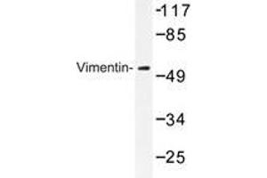 Western blot analysis of Vimentin antibody in extracts from 293 cells. (Vimentin antibody)