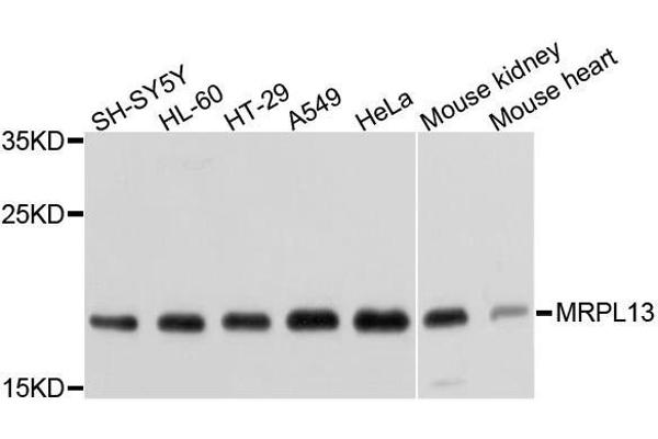 MRPL13 antibody  (AA 1-179)