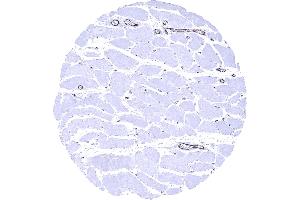 Skeletal muscle In skeletal muscle endothelial vWF immunostaining is strong in postcapillary venules and somewhat weaker in capillaries (Recombinant VWF antibody  (AA 1815-1939))