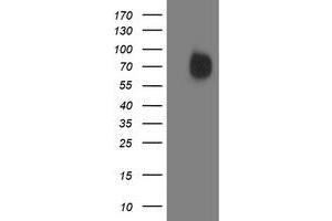 Western Blotting (WB) image for anti-Interferon Regulatory Factor 6 (IRF6) antibody (ABIN1498903) (IRF6 antibody)