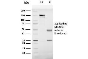 SDS-PAGE Analysis Purified Prohibitin Mouse Monoclonal Antibody (PHB/3229). (Prohibitin antibody  (AA 167-261))