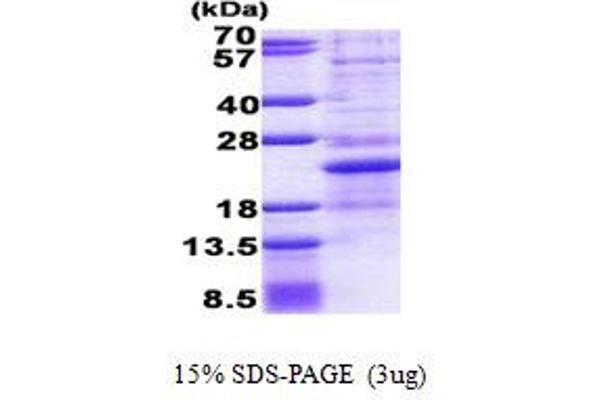 NHLH1 Protein (AA 1-133) (His tag)