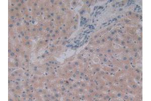 IHC-P analysis of Rat Liver Tissue, with DAB staining. (ENPEP antibody  (AA 409-624))